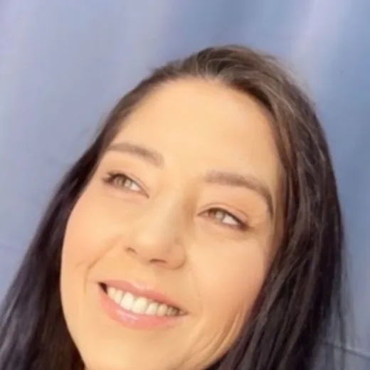 Depois — Botox